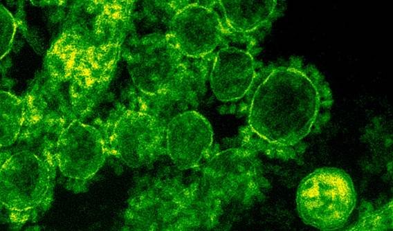 virus CSIC