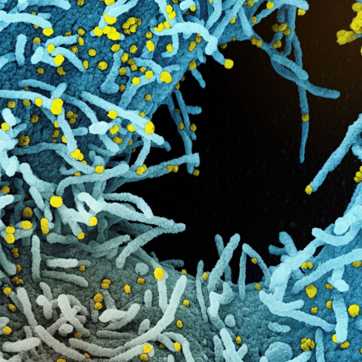 coronavirus