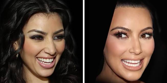 Antes Y Después Todas Las Operaciones De Kim Kardashian Antes Y Después 